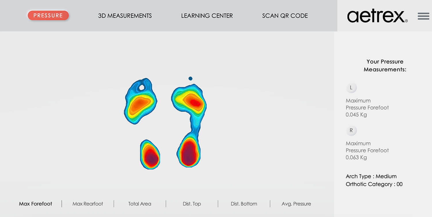 Aetrex 3D pressure